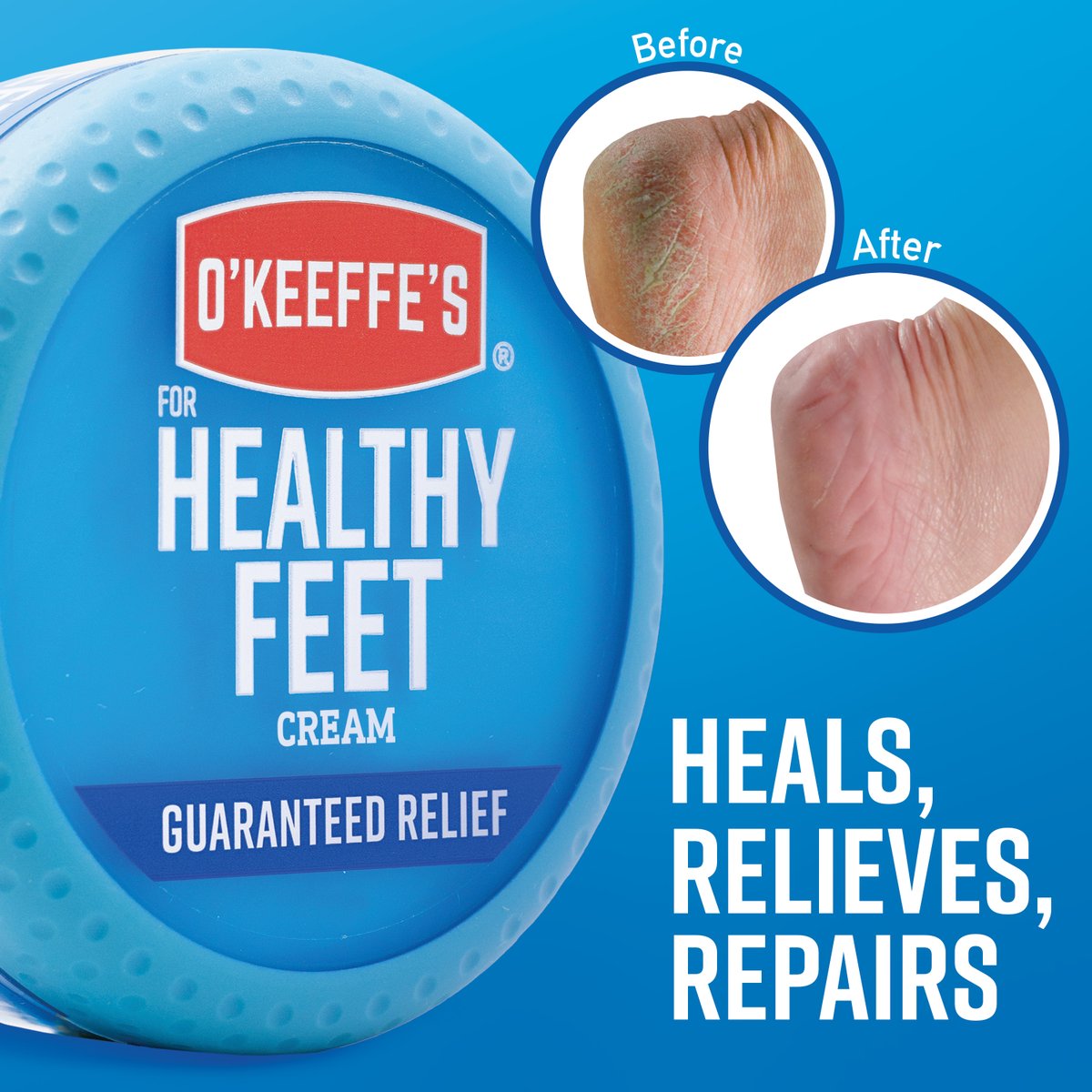 O'Keeffe's Healthy Feet foot cream provides relief for extremely dry, cracked feet. The results speak for themselves. 

#okeeffes #healthyfeet #hardworkingskincare #dryfeet #footcream