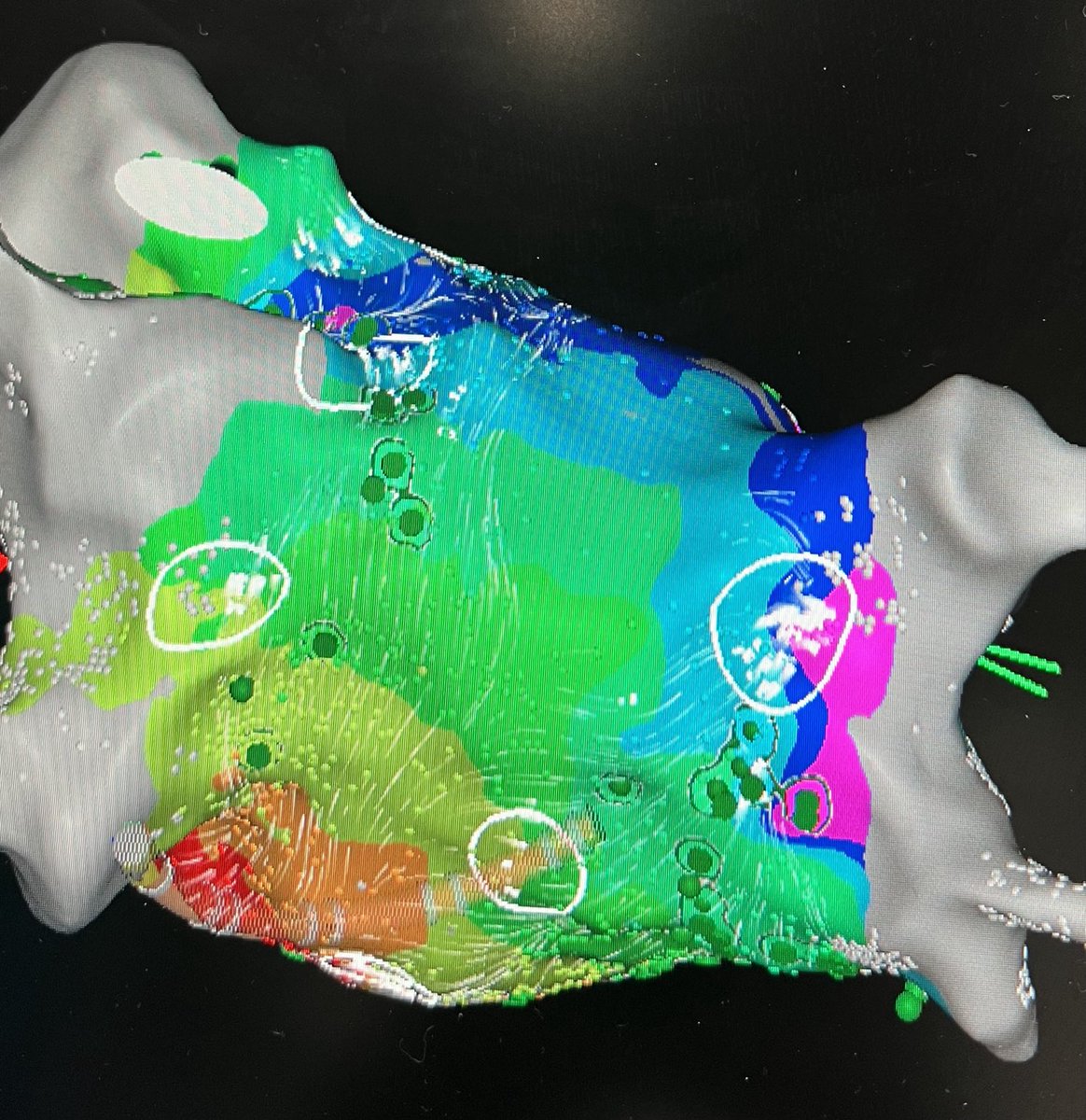 Smit Vasaiwala, MD tweet media