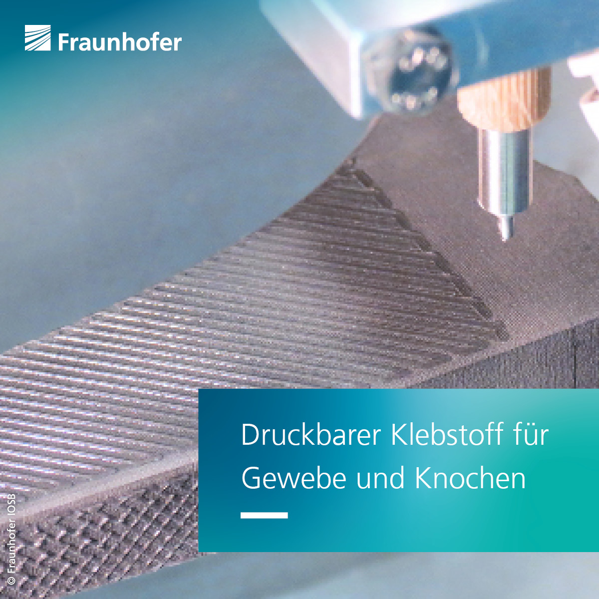Fraunhofer-Gesellschaft (@fraunhofer) on Twitter photo Einen #Gewebekleber, der Implantate mit dem Knochen verbindet oder Wunden zuklebt und via 3D-Drucker gedruckt werden kann, haben Forschende des <a href="/FraunhoferIAP/">Fraunhofer IAP</a> mit <a href="/FraunhoferIGB/">Fraunhofer IGB</a> und #FraunhoferCMI entwickelt. Mehr Infos: fraunhofer.de/de/presse/pres…
#Biomedizin #WeKnowHow Einen #Gewebekleber, der Implantate mit dem Knochen verbindet oder Wunden zuklebt und via 3D-Drucker gedruckt werden kann, haben Forschende des <a href="/FraunhoferIAP/">Fraunhofer IAP</a> mit <a href="/FraunhoferIGB/">Fraunhofer IGB</a> und #FraunhoferCMI entwickelt. Mehr Infos: fraunhofer.de/de/presse/pres…
#Biomedizin #WeKnowHow