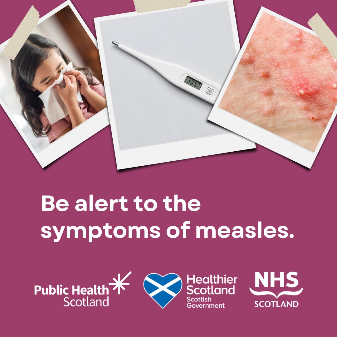 Cases of measles are on the rise, so it’s important to be aware of the symptoms. Find out about the signs and what to do if you think your child has measles at nhsinform.scot/MMRagainstMeas… 👨🏻‍💻 #MMRagainstMeasles 💉💪🏻