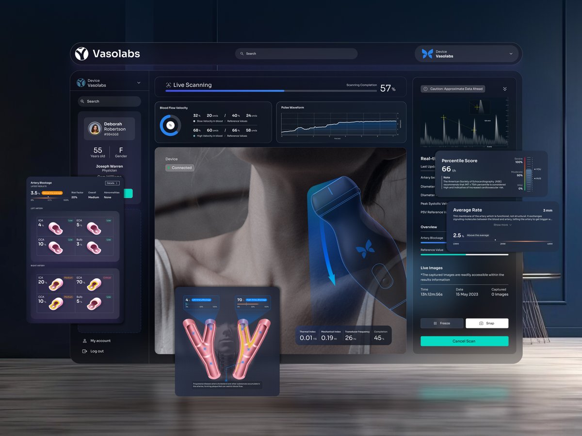 Vasolab artery scanning is tailored for universal benefit. Simplifying the intricacies of cardiovascular health data, it allows individuals and healthcare professionals to easily view artery specifics, concentrate on C-IMT, and envision potential risks through interactive graphs