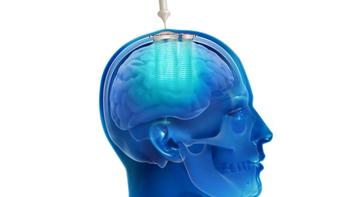 MedTechNow_'s tweet photo. #funding, #money #news 

~@yseopAI secures #investment to accelerate #GenerativeAI, new #investor includes @dRxCapital

~@worldwidetrials completes #recapitalization with @KKR_Co 

~@CarThera_ secures additional €4.5M for #innovative #medtech to treat #BrainDisorders https://t.co/spsgPx6sDK
