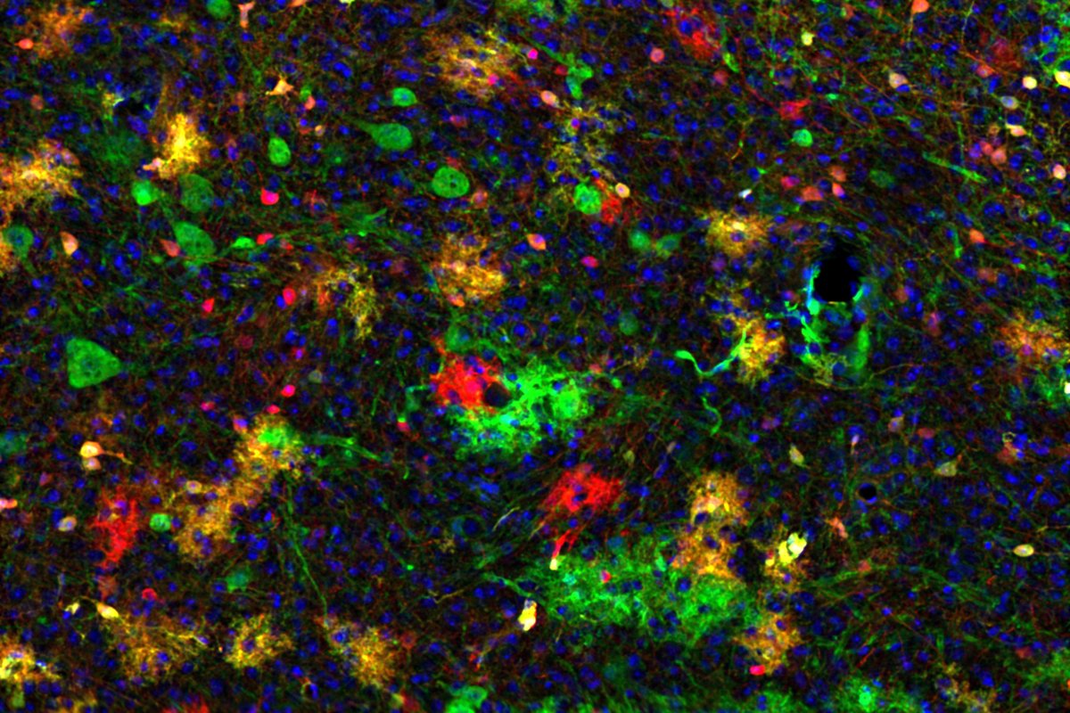 What can we learn from the family history of brain cells? @GiselleTYCheung, @pauler_m et al. from @HippenmeyerLab @ISTAustria traced the origin of cells in the superior colliculus and revealed a path to understand how brain disorders may arise.