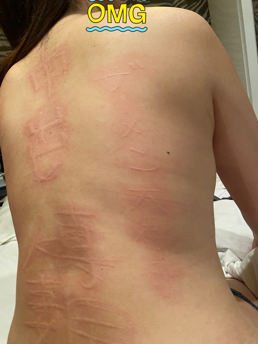 みみず腫れプレイを
淫乱人妻さんと。