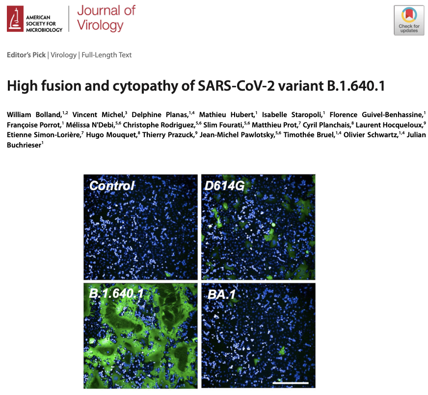 Olivier Schwartz Lab (@virus_immunity) on Twitter photo Our study on the high fusion and cytopathy of #SARSCoV2 -CoV-2 variant B.1.640 is now out!
Congrats to @Will_Bolland2, <a href="/JBuchrieser/">Julian Buchrieser</a> <a href="/Virus_Immunity/">Olivier Schwartz Lab</a> and all our collaborators @InstitutPasteur, <a href="/APHP/">Assistance Publique – Hôpitaux de Paris (AP-HP)</a> and CHR d’Orléans for this nice work!
journals.asm.org/eprint/GRWQRDB… Our study on the high fusion and cytopathy of #SARSCoV2 -CoV-2 variant B.1.640 is now out!
Congrats to @Will_Bolland2, <a href="/JBuchrieser/">Julian Buchrieser</a> <a href="/Virus_Immunity/">Olivier Schwartz Lab</a> and all our collaborators @InstitutPasteur, <a href="/APHP/">Assistance Publique – Hôpitaux de Paris (AP-HP)</a> and CHR d’Orléans for this nice work!
journals.asm.org/eprint/GRWQRDB…