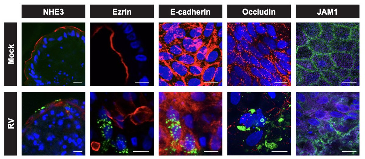 Estes Lab at BCM tweet media