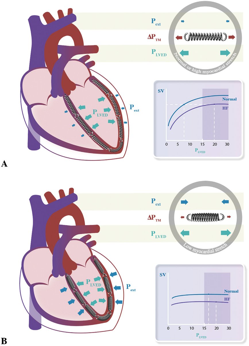 Hemodynamics is fascinating. PCWP may be surprisingly misclassifying PH patients, read our latest article at: authors.elsevier.com/a/1iFSGgQkysHx