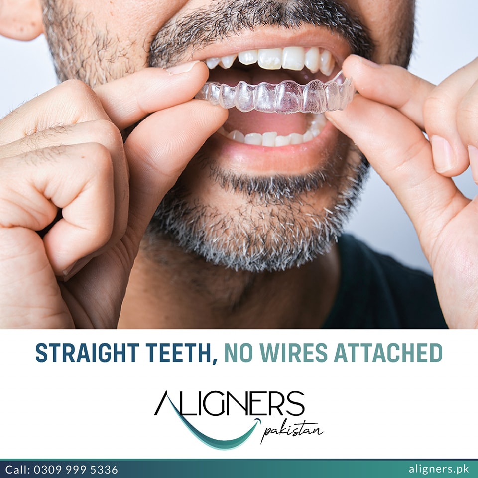 AlignersPK's tweet photo. Aligner Pakistan gives you straight teeth without the wire drama! Call at: 𝟎𝟑𝟎𝟗 𝟗𝟗𝟗 𝟓𝟑𝟑𝟔
#AlignerPakistan #StraighteningSmilesChangingLives #Orthodontics #DentalCare #SmileTransformation #smile #braces #dentist #dentistry #teeth #clearaligners #dental #clearbraces https://t.co/eWH6coTT3Y