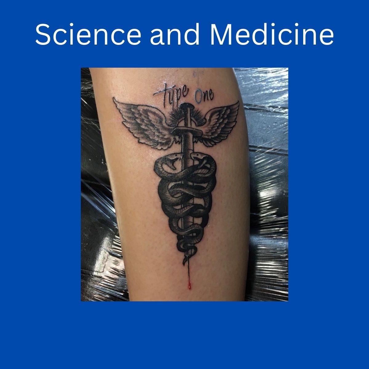 “The timing of my tattoo was important to me, as I was tattooed in honor of my 15th ‘Diaversary.’” 
Maya G., Missouri

Diabetes Ink closes, Fall 2024

#bantinghouse #birthplaceofinsulin #diabetes #insulin #ldnont #cdnhistory #histmed #letsenddiabetes #tattoo #tattooart #ldnmuse