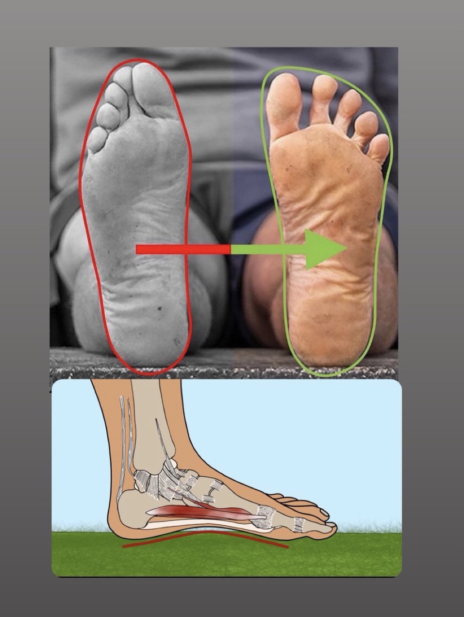 Narrow toe box sale