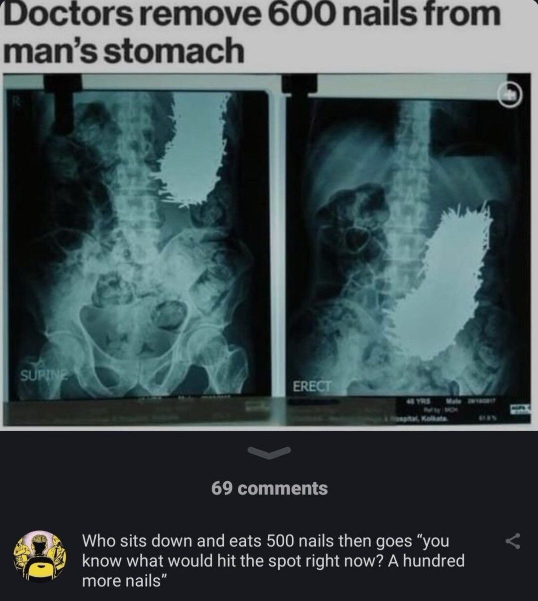 star 💫 (@stxrinsky) on Twitter photo 