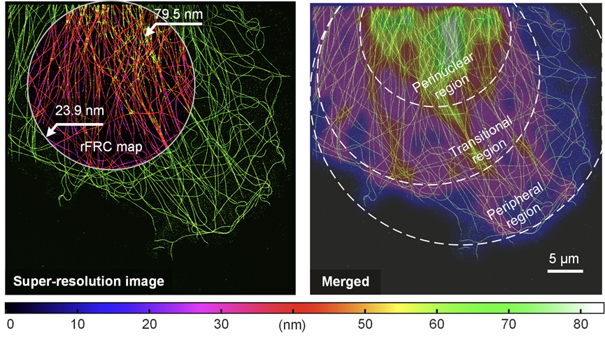 weisong_zhao's tweet photo. Out at @LightSciAppl just now!

Very happy to share a nice tool we recently developed, the #rFRCmetric, evaluating the super-resolution (SR) quality at the corresponding SR scale.

The upscaled resolvability of super-resolution imaging requires a more elaborate evaluation!
(1/n) https://t.co/9dE1SKwcNn
