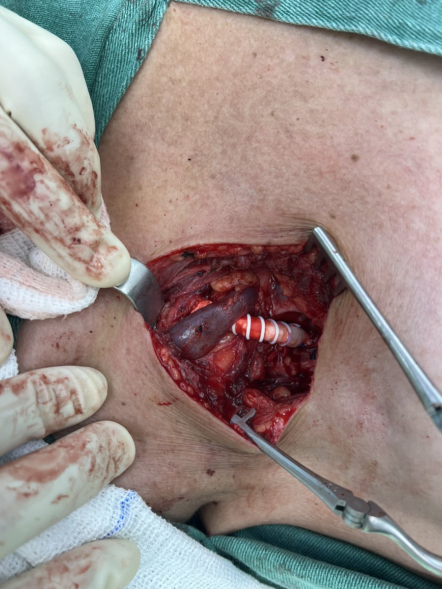 André Poci tweet media