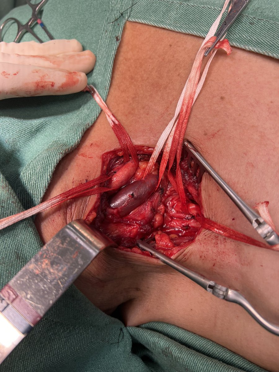 André Poci tweet media