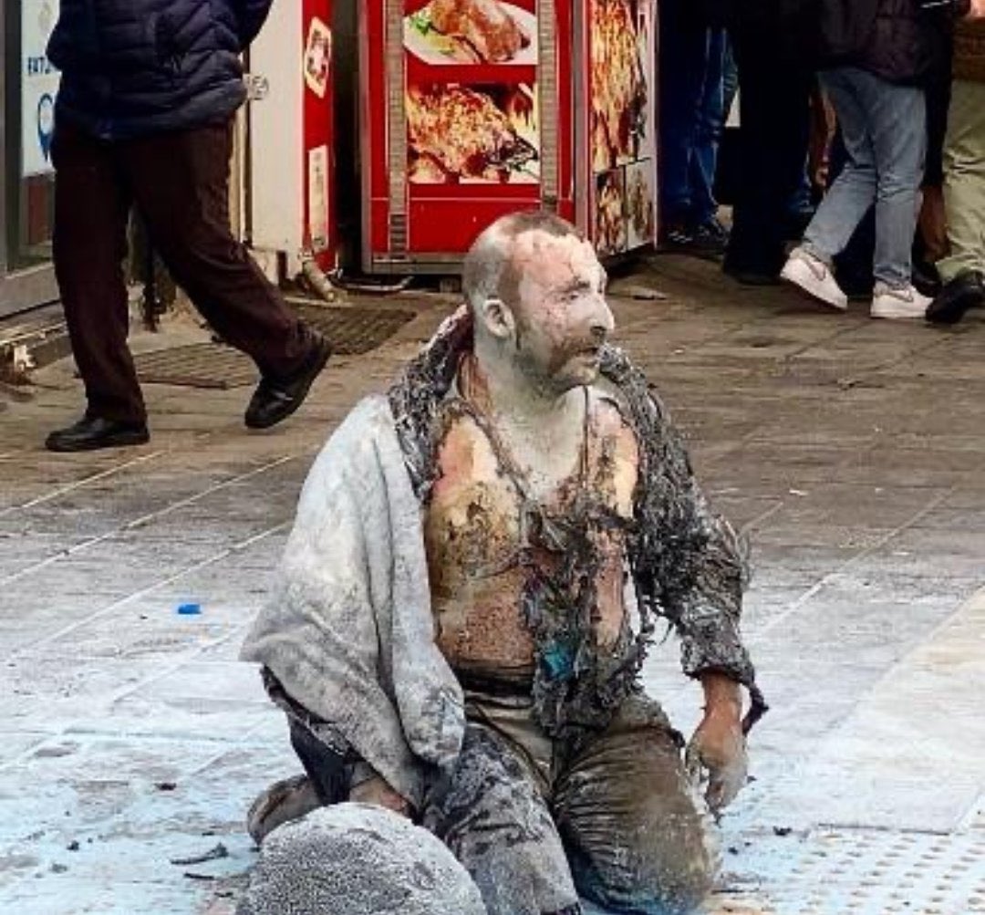 Bu fotoğraf, vicdansızlığı ve ahlaksızlığı örgütleyip çeteleşerek, ülkenin başına bela olan, talancı-dinci gerici-ırkçılığın ülkeyi ne hale getirdiğinin belgesidir.