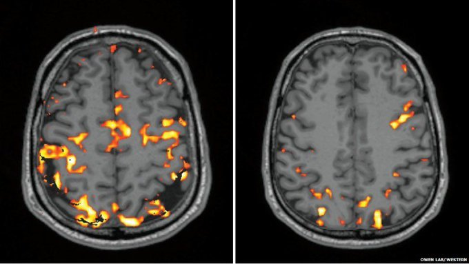 cajunkoi's tweet photo. Recently, I came across a study on how lack of sleep damages your energy, focus, and brain function.

If you sleep less than 8 hours a day, read this: https://t.co/ftcYQbwLTo