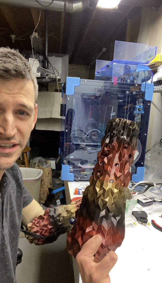 yerg's tweet photo. @HTX_Global Why can I scan my arm and generate in software a 3D print that can be printed in a day, cheaply, but this doesn’t exist in the world due to barriers https://t.co/xIPi5ON1Ff