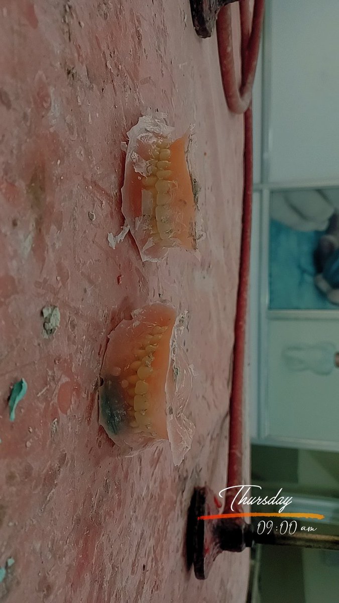 _____mr_perfect's tweet photo. From Zero to hero 
#PROSTHODONTICS https://t.co/UvhZkZKA74