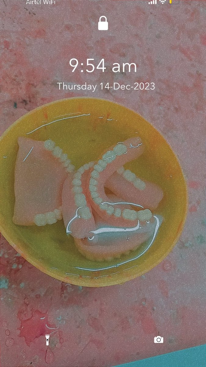 _____mr_perfect's tweet photo. From Zero to hero 
#PROSTHODONTICS https://t.co/UvhZkZKA74