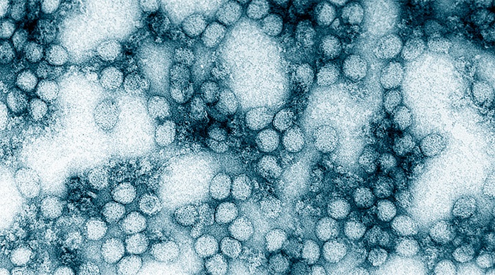 Cientistas da <a href="/usponline/">USP - Universidade de São Paulo</a> e do Emílio Ribas analisam em detalhes lesões causadas pela #febreamarela no coração. Em <a href="/eBioMedicine/">eBioMedicine – The Lancet Discovery Science</a>, grupo descreve dados clínicos, laboratoriais e aspectos do tecido cardíaco a partir de autópsias feitas em epidemia de 2017/19. agencia.fapesp.br/50474