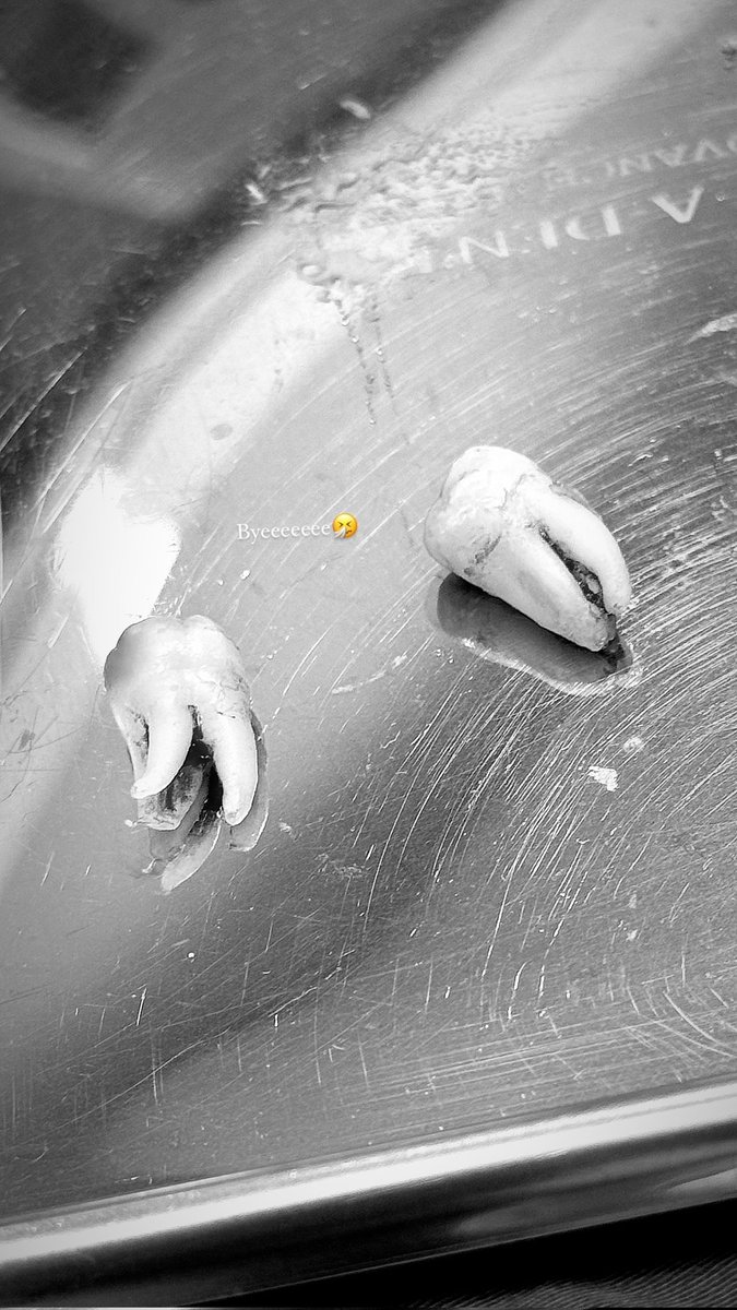 srchakimfreen's tweet image. 사랑니 뺀 김프린... 너무 궁금해
말랑볼 귀여워... 벌써 귀여워...🤏🏻🤏🏻🤏🏻🤏🏻🤏🏻

#srchafreen