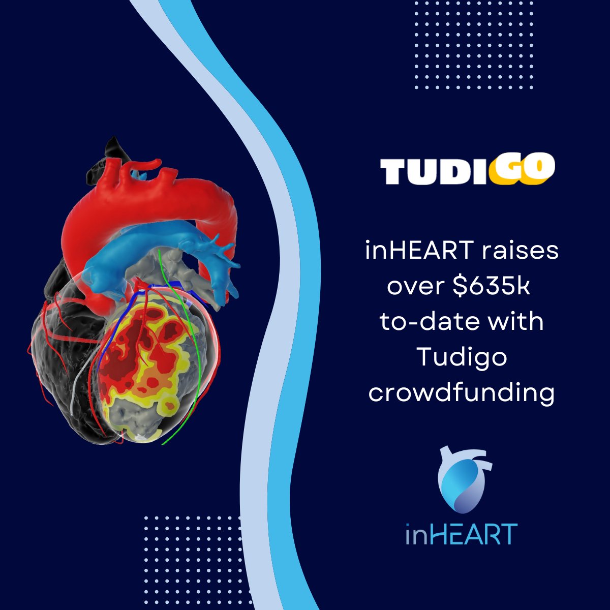 inHEART is excited to announce that we have exceeded our goal of $500k with our Tudigo crowdfunding efforts!!! We have currently raised over $635k…and that number is growing every day. Congrats to the inHEART team.
#tudigo #startupinvesting #MedTech