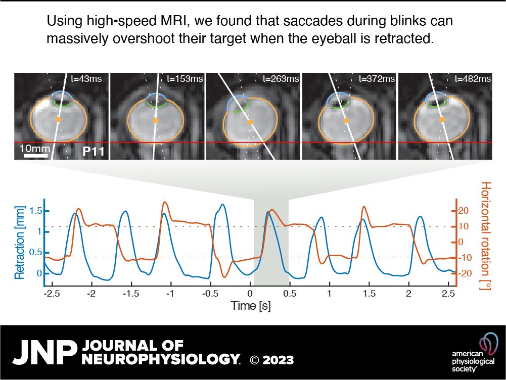 JNeurophysiol's tweet photo. 👁🧠New research➡Eyeball translations affect saccadic eye movements beyond brainstem control by Johannes Kirchner (@jkirchnerwwu) et al.
🖱https://t.co/aiM2CtGoRS
#EyeMovement #saccade #MRI #neurophysiology #neuroscience https://t.co/hyasHUzKZX