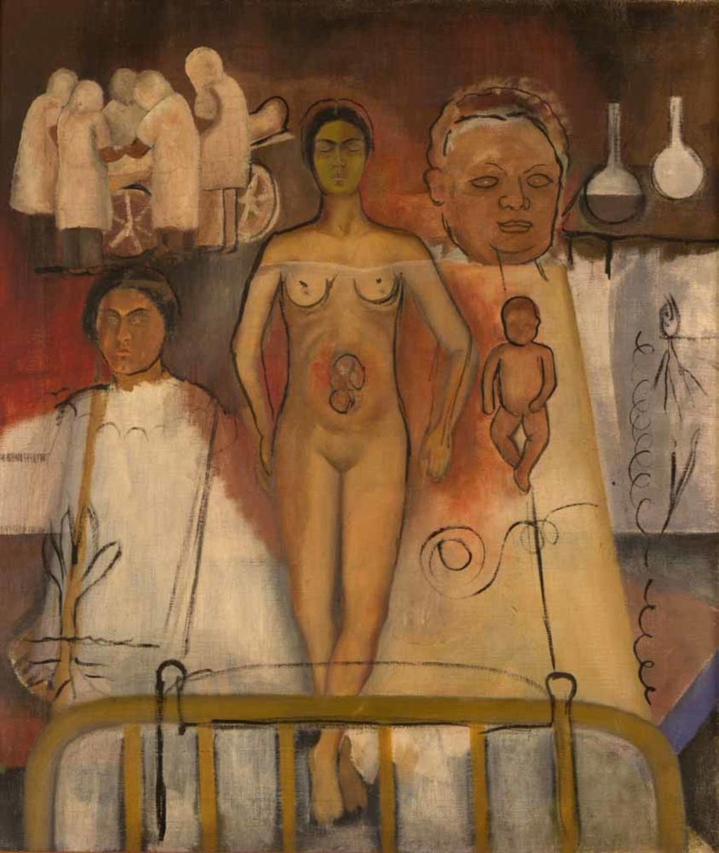 “Frida y la cesárea.” (1931) #FridaArt #FridaKahlo #Art