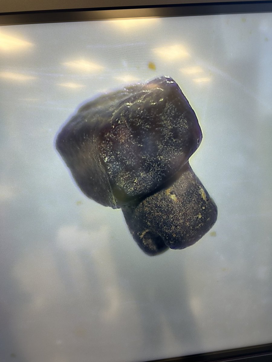 FCSreader's tweet image. And I thought I was the oldest thing @FranklintonMS!!  8th grade science classes are helping @NaturalSciences find micro fossils!  The Microeye is coming in very handy @UnitedWayFC in magnifying our samples.