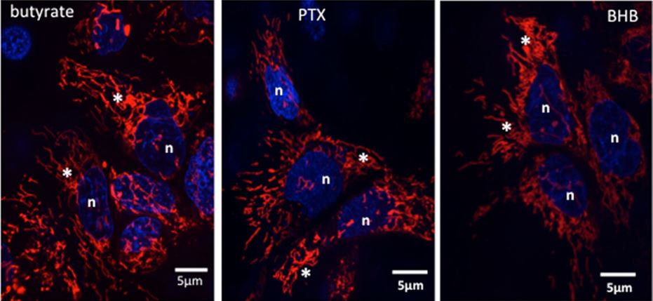 Intestinal Cell News (@intestinal_cell) on Twitter photo E. coli-LF82 causes fragmentation ✂️ that increases #epithelial permeability.
Dr. Derek McKay (<a href="/Lab_DerekMcKay/">DerekMcKay lab</a>) and researchers at <a href="/UCalgaryMed/">UCalgaryMedicine</a> hypothesized that butyrate would limit the epithelial #mitochondrial disruption caused by E. coli-LF82.
👉 bit.ly/46UXctq E. coli-LF82 causes fragmentation ✂️ that increases #epithelial permeability.
Dr. Derek McKay (<a href="/Lab_DerekMcKay/">DerekMcKay lab</a>) and researchers at <a href="/UCalgaryMed/">UCalgaryMedicine</a> hypothesized that butyrate would limit the epithelial #mitochondrial disruption caused by E. coli-LF82.
👉 bit.ly/46UXctq