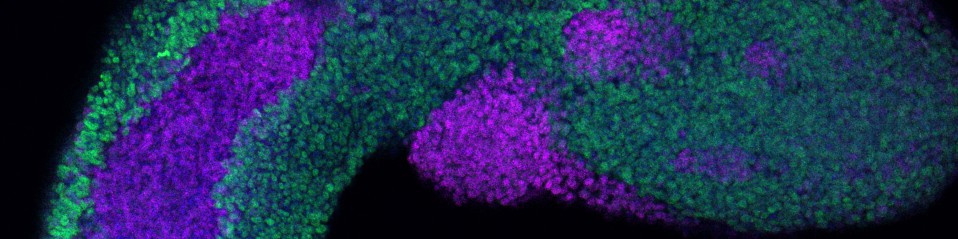 I am thrilled to share that I will be starting my own research group in the Department of Developmental Biology at Utrecht University.

My lab will explore the interplay between gene regulation and tissue-tissue interactions in embryo models.

#BraccioliLab #UtrechtUniversity