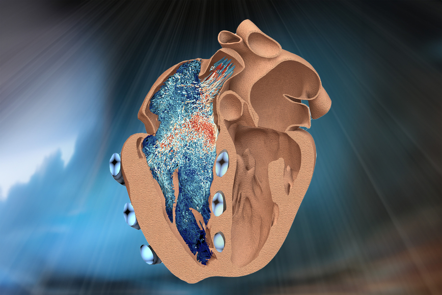 MIT IMES (@mit_imes) on Twitter photo .<a href="/MIT/">Massachusetts Institute of Technology (MIT)</a> engineers have developed a robotic replica of the heart’s right ventricle, which mimics the beating and blood-pumping action of live hearts. <a href="/manisha_s1ngh/">Manisha Singh</a> <a href="/ellentroche/">Ellen Roche MIT</a> <a href="/MIT_IMES/">MIT IMES</a> <a href="/MITMechE/">MIT MechE</a> <a href="/MassGeneralNews/">MassGeneral News</a> <a href="/BostonChildrens/">Boston Children's</a> bit.ly/46Y0Hj0 .<a href="/MIT/">Massachusetts Institute of Technology (MIT)</a> engineers have developed a robotic replica of the heart’s right ventricle, which mimics the beating and blood-pumping action of live hearts. <a href="/manisha_s1ngh/">Manisha Singh</a> <a href="/ellentroche/">Ellen Roche MIT</a> <a href="/MIT_IMES/">MIT IMES</a> <a href="/MITMechE/">MIT MechE</a> <a href="/MassGeneralNews/">MassGeneral News</a> <a href="/BostonChildrens/">Boston Children's</a> bit.ly/46Y0Hj0