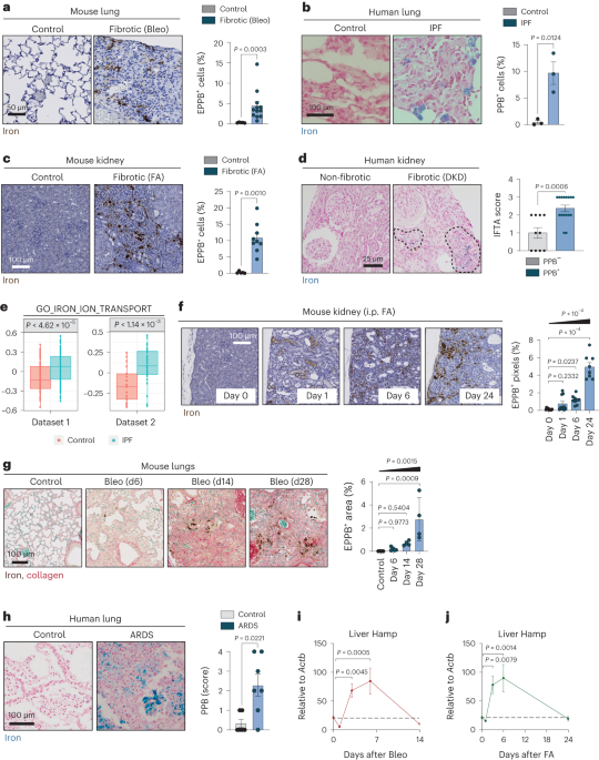 NatMetabolism's tweet image. Online now! Iron accumulation drives fibrosis, senescence and the senescence-associated secretory phenotype dlvr.it/T090tV