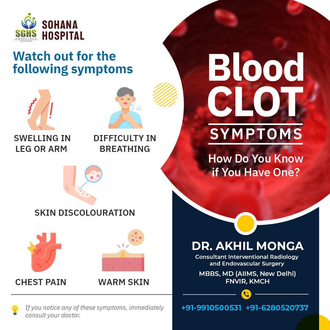 A blood clot can block the blood supply of the affected area and can cause serious problems, even leading to death. It is very important to recognize its symptoms at the right time. bit.ly/3X0x64x #bloodclot #legswelling #chestpain #bloodclotsymptoms #skindiscolouration