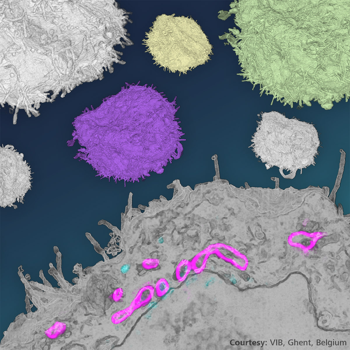 In the upcoming event “From 3D Light to 3D Electron Microscopy”, learn about correlative light-electron microscopy (CLEM) &amp; Volume EM and how they are used to reveal biological processes and their ultrastructural context in 3D.

From March 19 – 22, join <a href="/VIBLifeSciences/">VIB</a> <a href="/TheCrick/">The Francis Crick Institute</a>