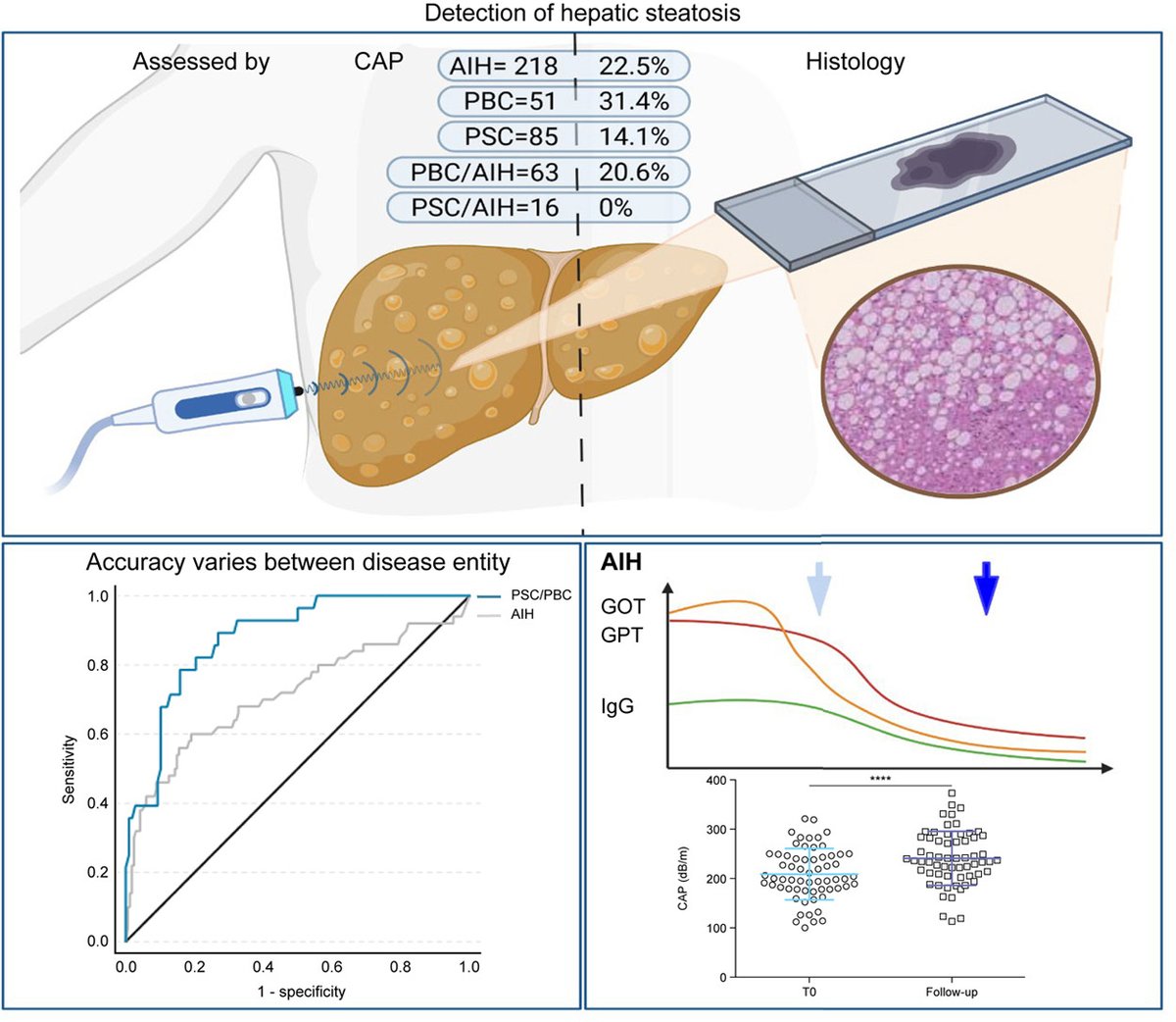 Accuracy of controlled attenuation parameter measurement for the detection of steatosis in autoimmune liver diseases 🔓#OpenAccess at 👉 jhep-reports.eu/article/S2589-… #LiverTwitter #Steatosis #AutoimmuneHepatitis