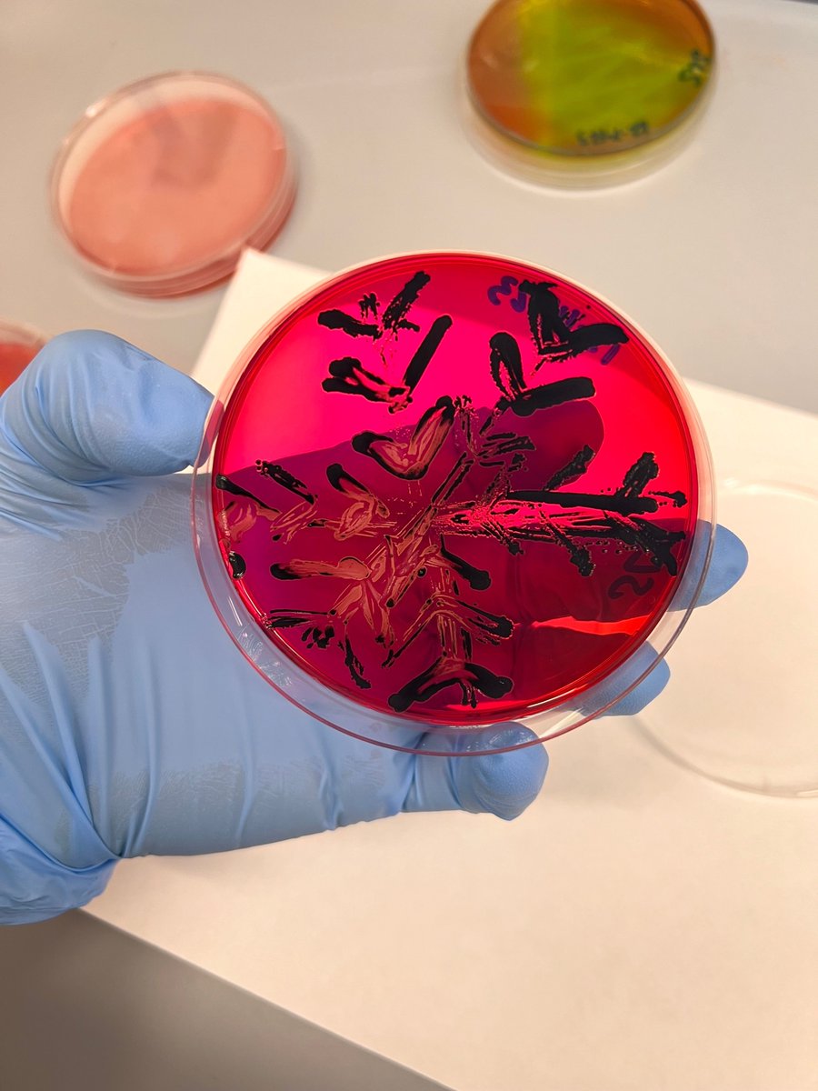 What do you do when you have extra media plates that need to be used up before the winter break? Create super fun holiday-themed bacteria plates! Check out some of the fun creations some members of the Ganda Lab came up with using differentiation media and specific bacteria!