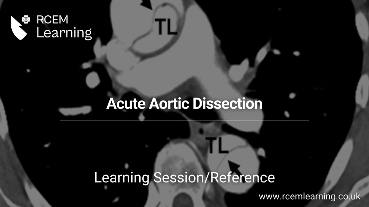 UPDATE: This session covers the diagnosis and initial management of a patient with acute aortic dissection. Check out our #LearningSession and #Reference: LS: rcemlearning.co.uk/modules/acute-… Ref: rcemlearning.co.uk/reference/aort…