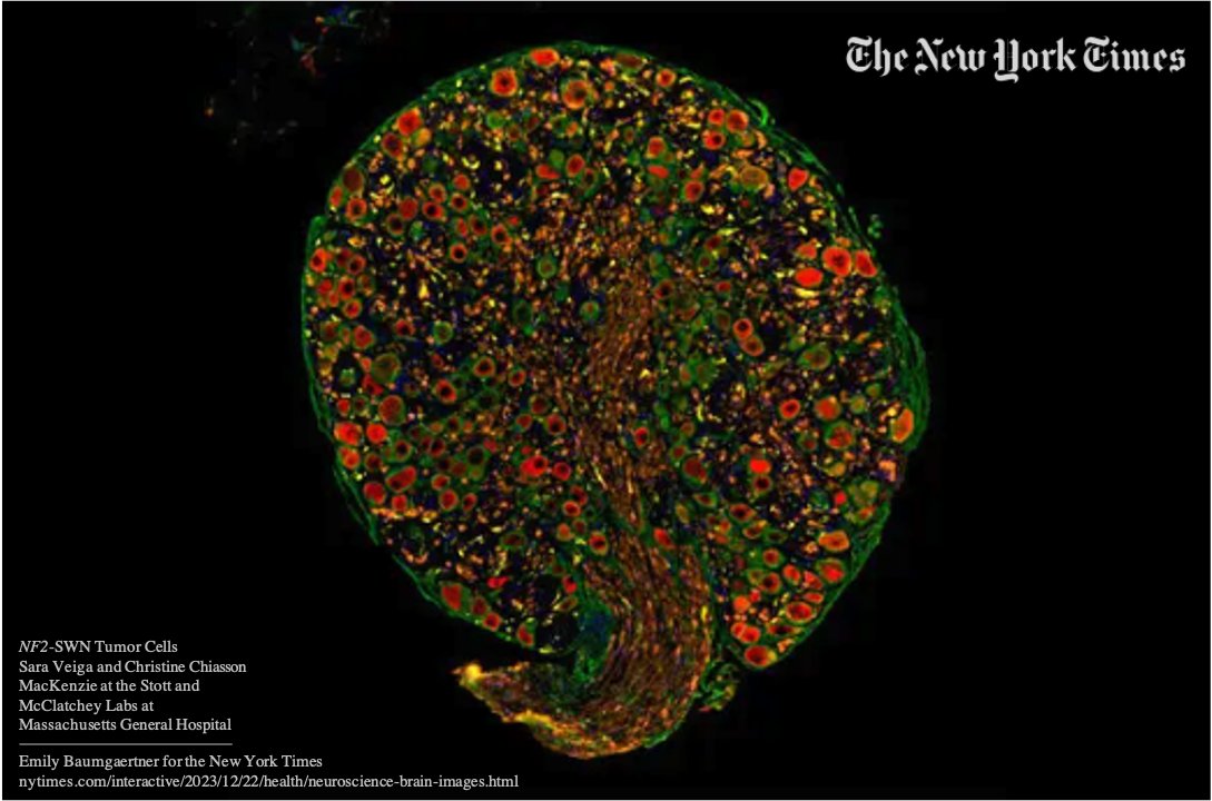Children's Tumor Fdn tweet media