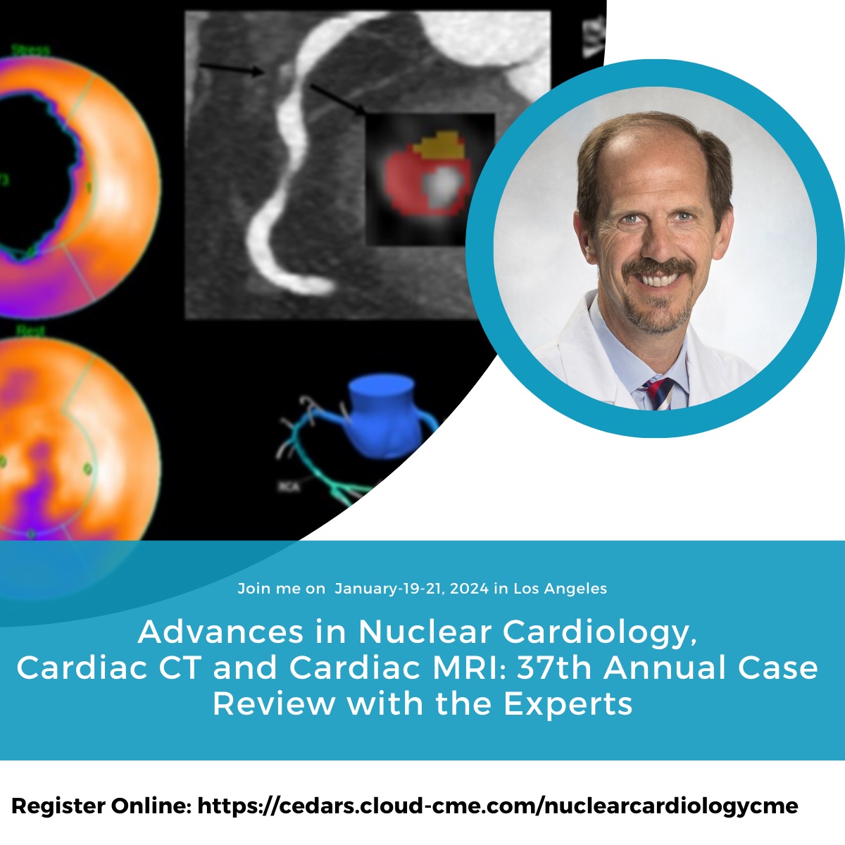🌟 Unlock the Power of Cardiac Imaging and join us Jan 19-21, 2024. Hands down the best course to master the latest in cardiac imaging with expert insights, case studies, and interactive hands-on learning! #ACCFIT #ACCImaging #CVnuc #YesCCT #YesCMR