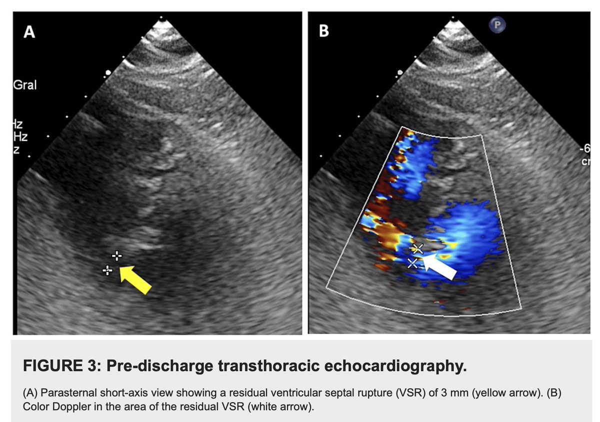 Juan Munoz-Moreno, MD, FACC tweet media