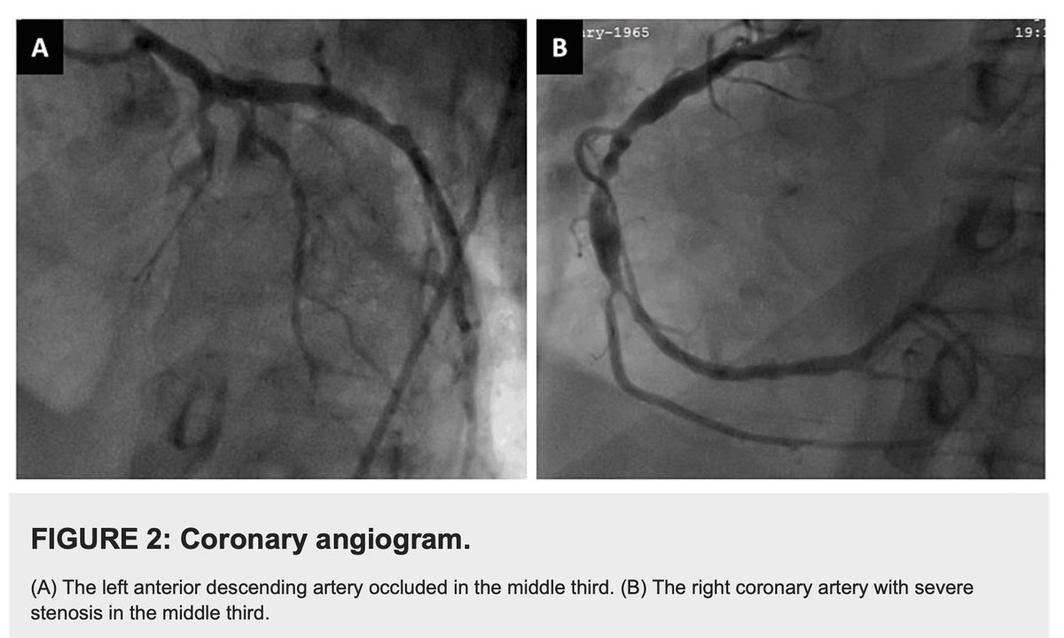 Juan Munoz-Moreno, MD, FACC tweet media