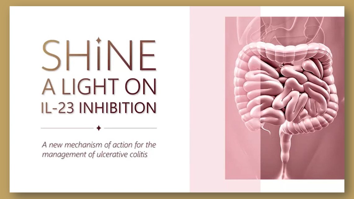 RECORDING NOW AVAILABLE! Shine a light on IL-23 inhibition: A new mechanism of action for the management of ulcerative colitis with @guthealthmd @vipuljairath @marshllj @SeowCynthia and @yleungibd Become a SCOPE member to watch on demand at scopecanada.org/other-programs