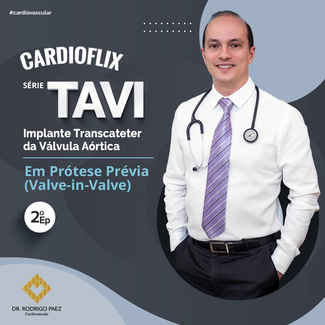 TAVI em Prótese Prévia (Valve-in-Valve). Episódio 2.

Assista ao vídeo e tire suas dúvidas: youtu.be/ce50auT9_fs

#TAVI #TAVR #proteseprevia #estenoseaortica #valvulaaortica #valveinvalve #circulacaoextracoporea #cirurgiacardiaca #cirurgiacardiovascular #cirurgiaocardiaco #sp