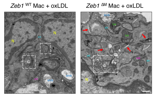 Regulation of Cell Plasticity Group (@genereglab) on Twitter photo 📌
🤔 Interested in how #CellPlasticity & #ZEB1 regulate #macrophages #metabolism ❓
➡️Check our 2 x <a href="/NatureComms/">Nature Communications</a> this month
1⃣ #inflammation & #mitochondria translation 🔗t.ly/8guvp
2⃣ traffic #lipids / systemic inflamm & #atherosclerosis 🔗t.ly/KFayz 📌
🤔 Interested in how #CellPlasticity & #ZEB1 regulate #macrophages #metabolism ❓
➡️Check our 2 x <a href="/NatureComms/">Nature Communications</a> this month
1⃣ #inflammation & #mitochondria translation 🔗t.ly/8guvp
2⃣ traffic #lipids / systemic inflamm & #atherosclerosis 🔗t.ly/KFayz