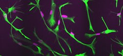 Young Glial Research Team (@labglial) on Twitter photo We look forward to starting work on our NHMRC Ideas grant with <a href="/FletcherJL/">Dr Jessica L. Fletcher</a>, <a href="/nickomatics/">Nicholas Blackburn</a>, <a href="/BradASutherland/">Brad Sutherland</a> and <a href="/BruestleLab/">Bruestle Lab</a>. Together we will find out how MS-associated genetic variants alter brain cell function. We look forward to starting work on our NHMRC Ideas grant with <a href="/FletcherJL/">Dr Jessica L. Fletcher</a>, <a href="/nickomatics/">Nicholas Blackburn</a>, <a href="/BradASutherland/">Brad Sutherland</a> and <a href="/BruestleLab/">Bruestle Lab</a>. Together we will find out how MS-associated genetic variants alter brain cell function.