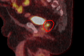 Dr. Andrew Loblaw tweet media