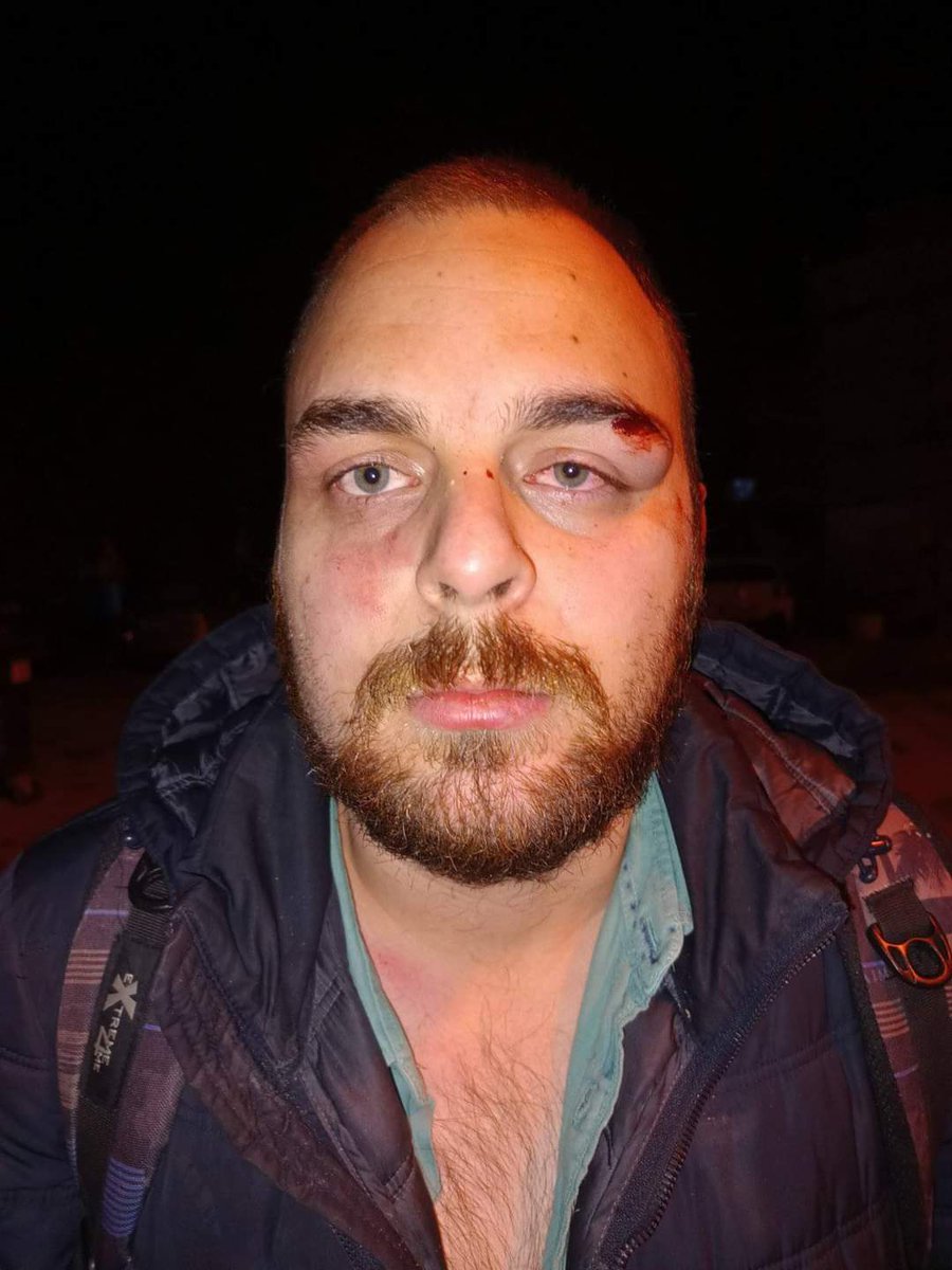 Naš aktivista Srđan Đurić sinoć je brutalno prebijen na ulici u Novom Sadu! Nasilje će prestati, samo ako ga pobedimo. Sutra je ta prilika! SRBIJO PROBUDI SE!