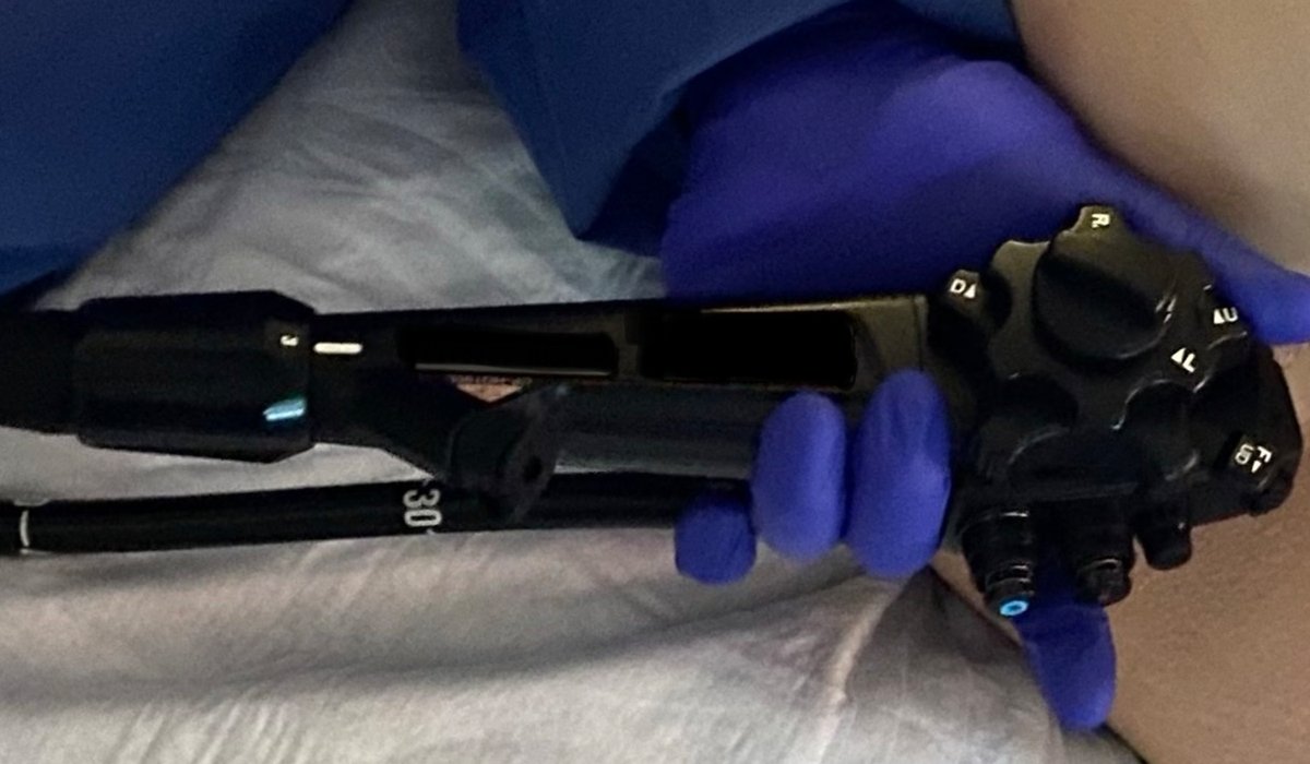 AGA_CGH's tweet image. #Polypectomy Techniques for Pedunculated and Nonpedunculated #Polyps ow.ly/GurV50QjcbS @GI_Guy