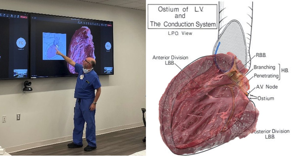 PennEPFellows's tweet photo. Learning cardiac anatomy from the best! Anatomy is the key to EP. @DrFerminGarcia #EPeeps @PennCardiology https://t.co/MpeuOoLUKc